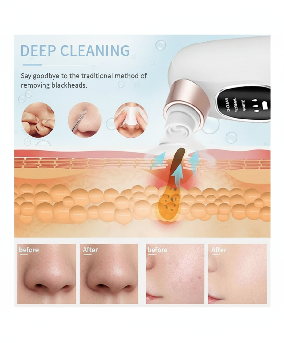 blackhead remover vacuum cleaner, Electric Facial Cleaner for Acne, Pimples, Blackheads